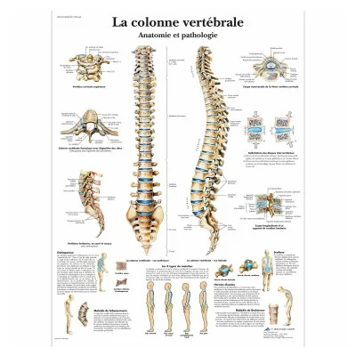 Planche anatomique - La colonne vertébrale - Anatomie et pathologie