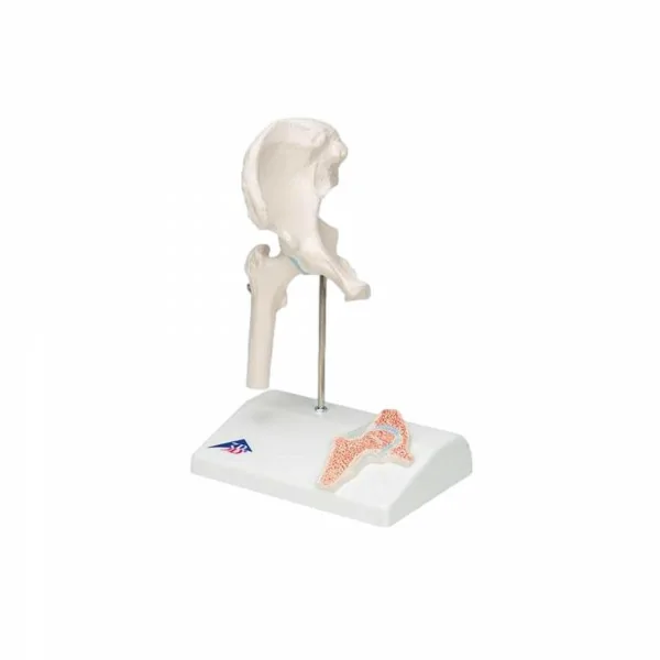 Mini-articulation de la hanche avec coupe transversale, sur socle - Anatomie et pathologie