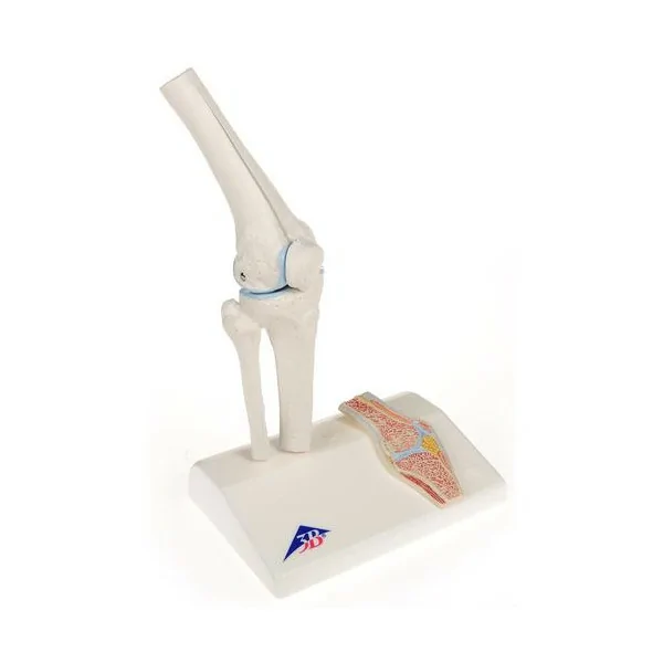 Mini-articulation du genou avec coupe transversale, sur socle - Anatomie et pathologie