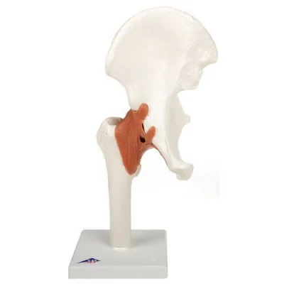 Articulation de la hanche - Modèle fonctionnel - Anatomie et pathologie fabriqué par 3B Scientific vendu par My Podologie