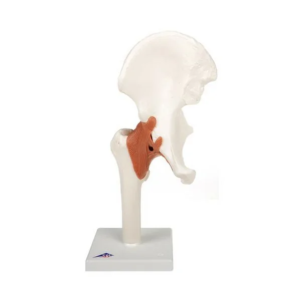 Articulation de la hanche - Modèle fonctionnel - Anatomie et pathologie