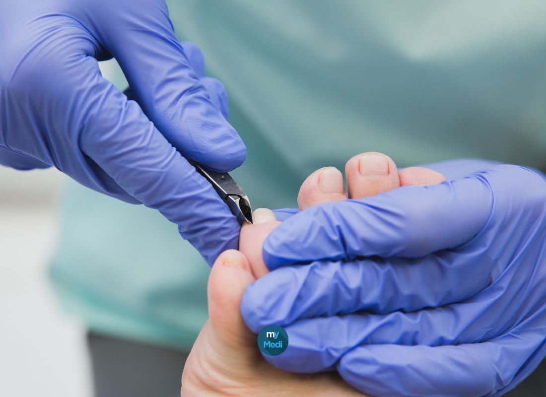 Comment bien choisir sa pince à ongles ?