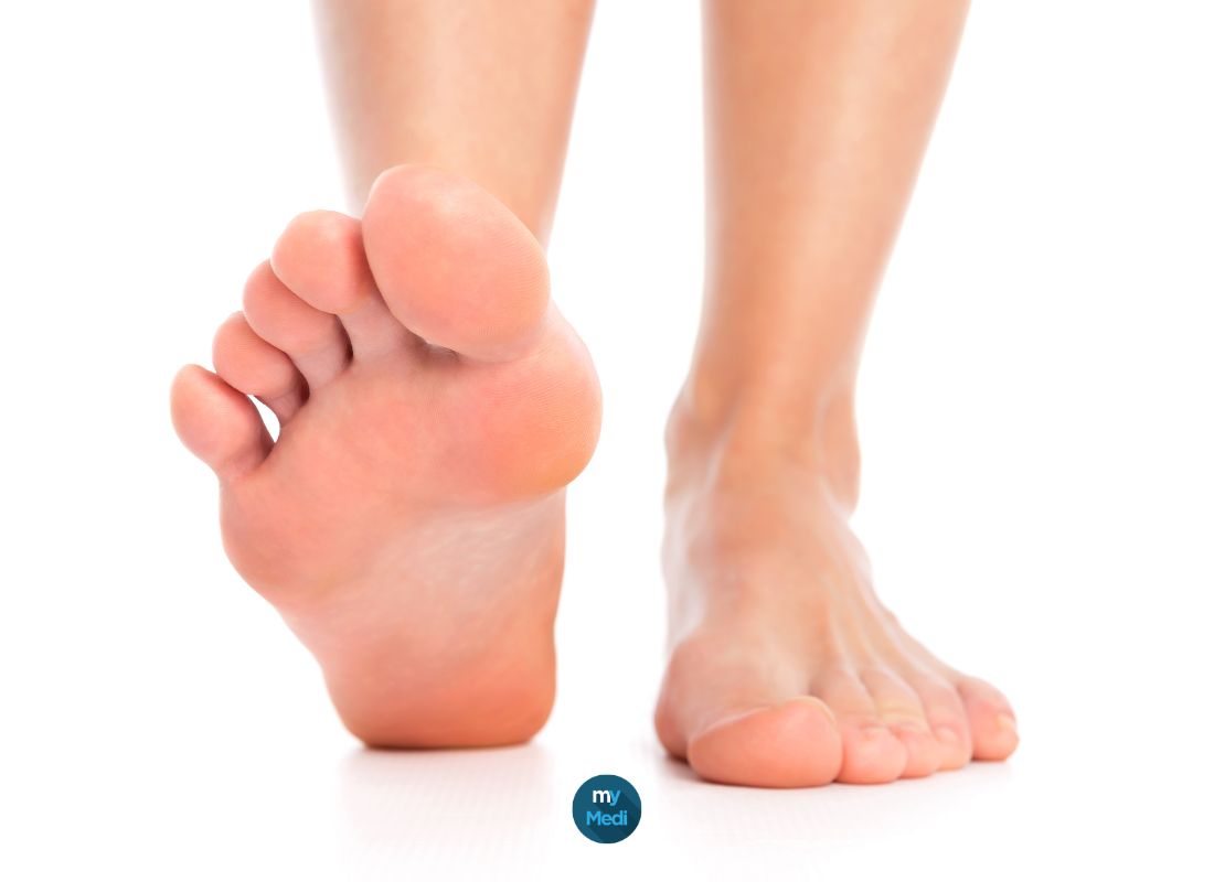 Nouveauté : Les dispositifs orthopédiques Epitact chez My Médical