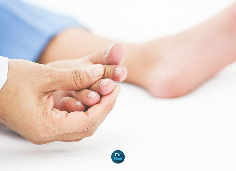 Orteil en marteau ou orteil en griffe : que faire ?