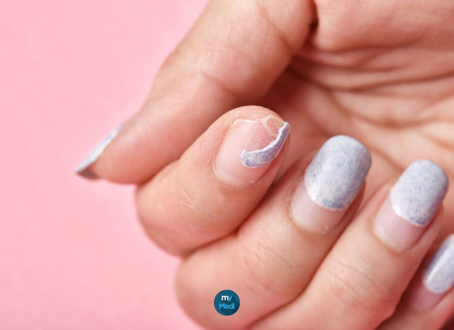 Problèmes d'ongles mous, cassants, qui se dédoublent