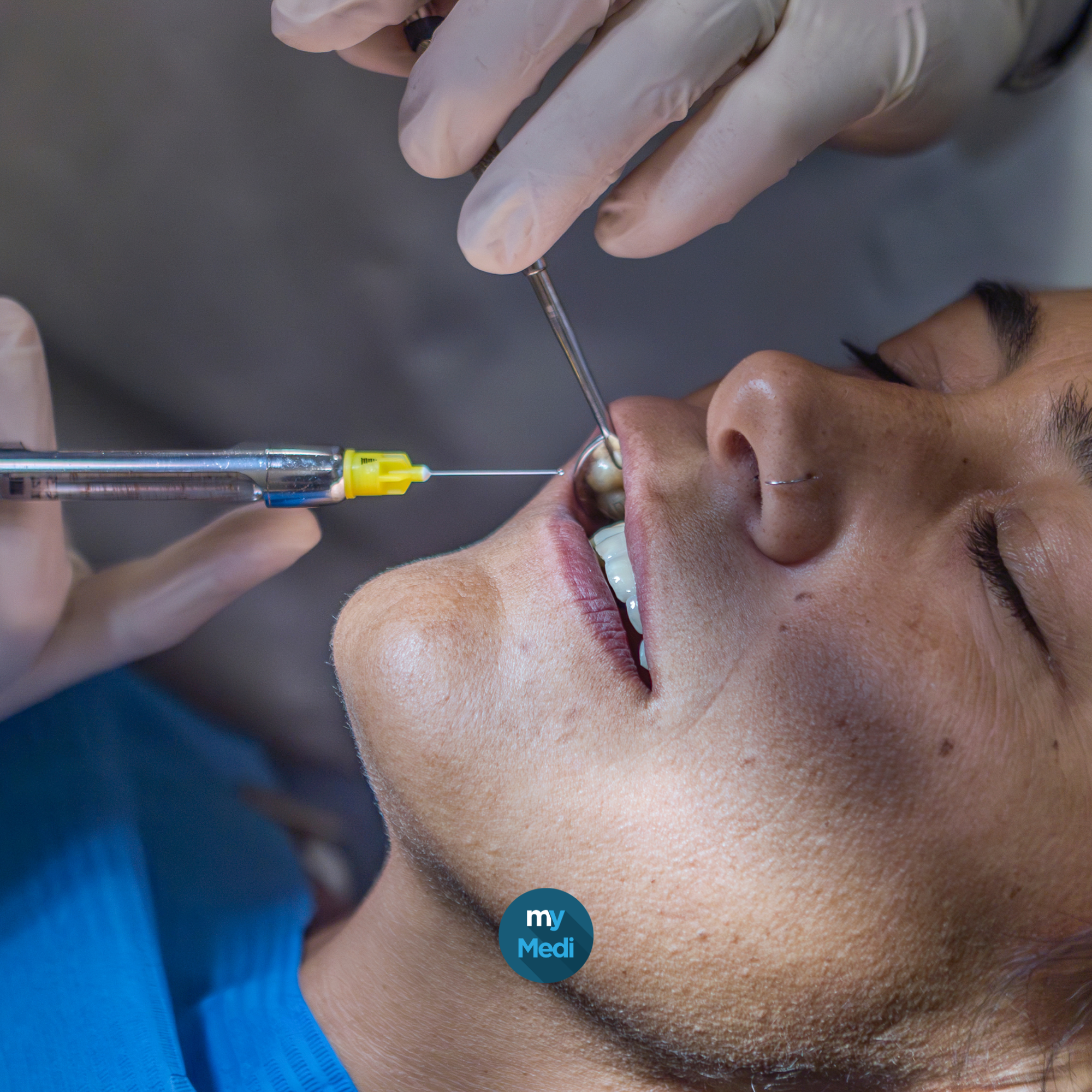 Aiguilles d'anesthésie dentaires