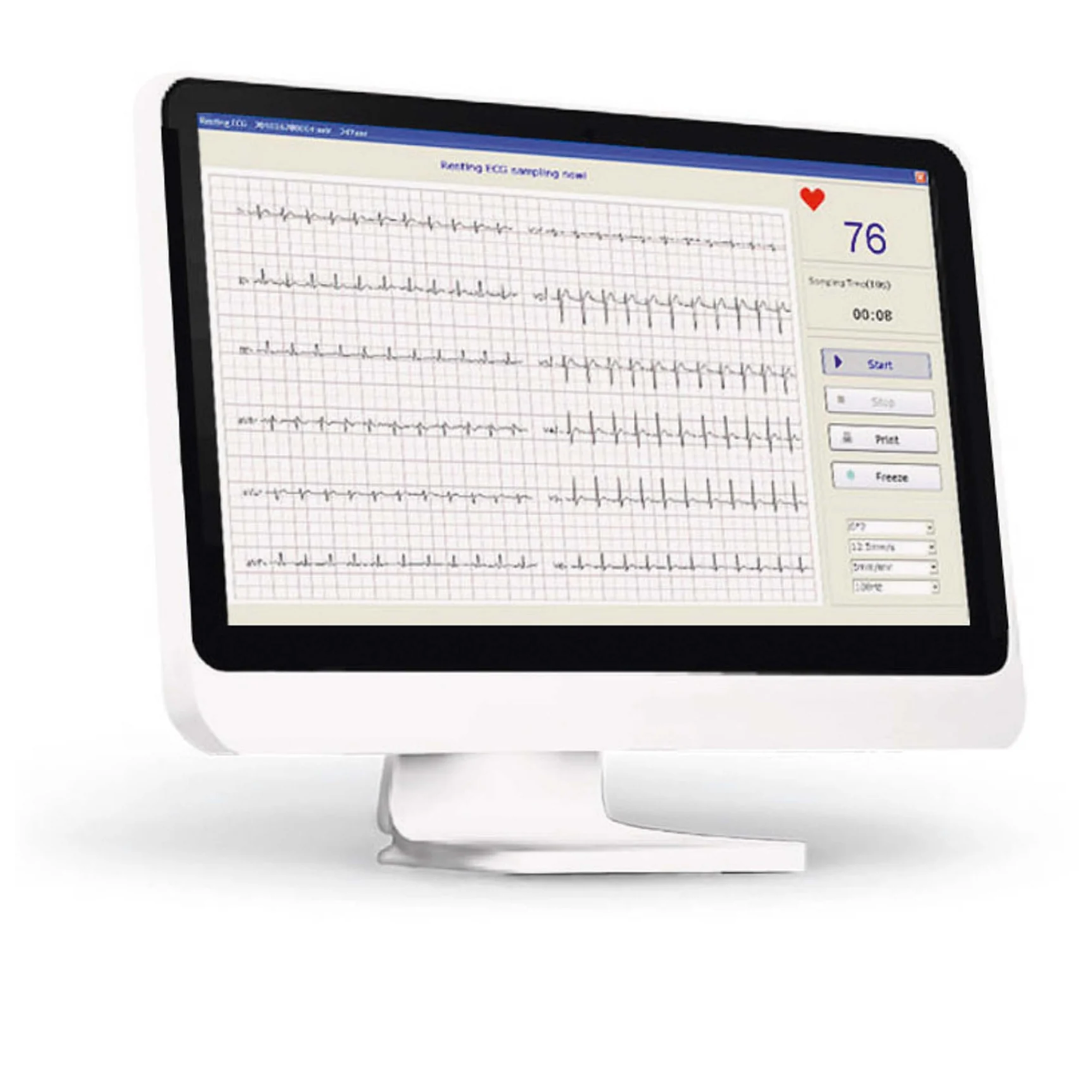 ECG Numerique PC SE-1010 - EDAN