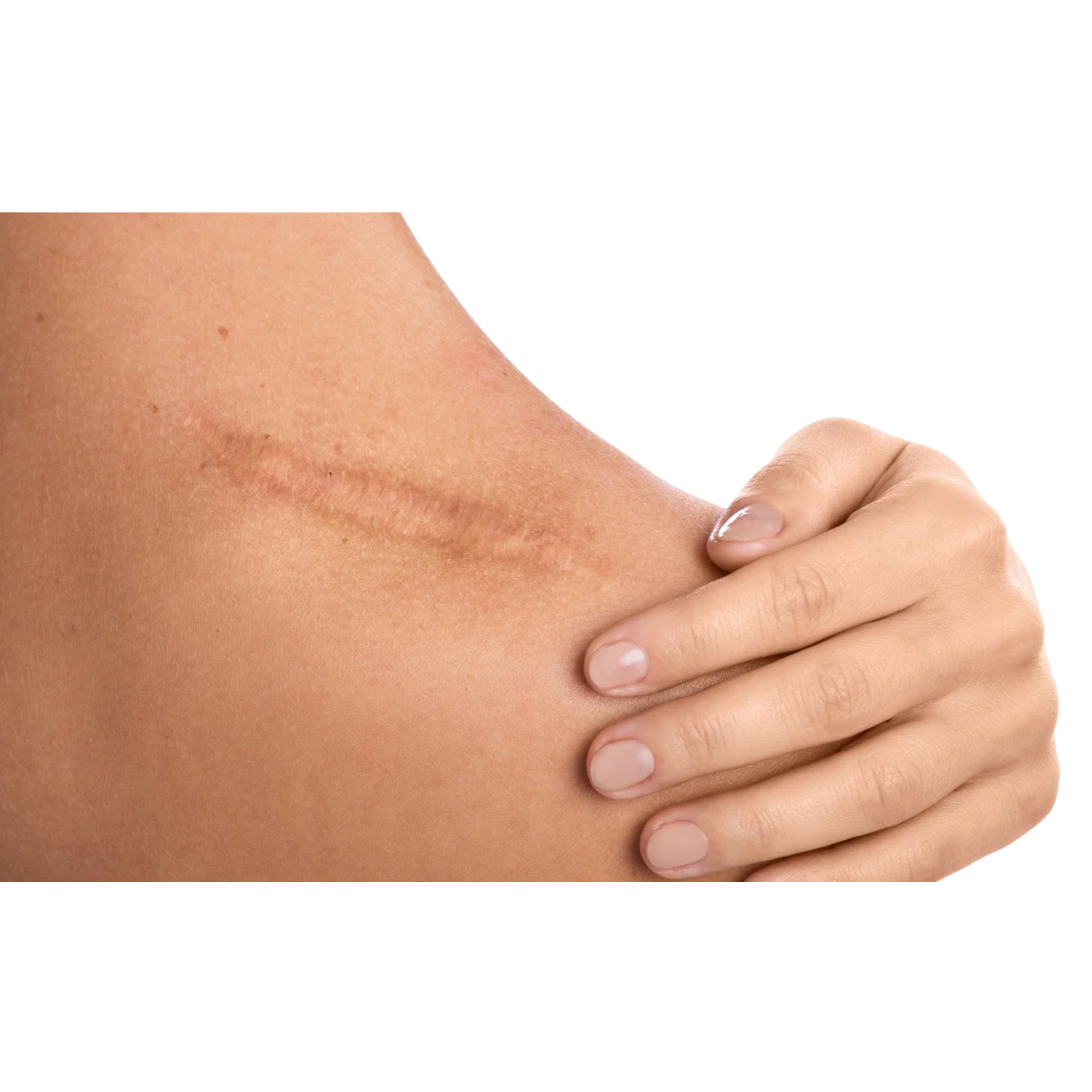 Huile de soin - Cica7 - Zones Cicatricielles - Roll-On - Eona