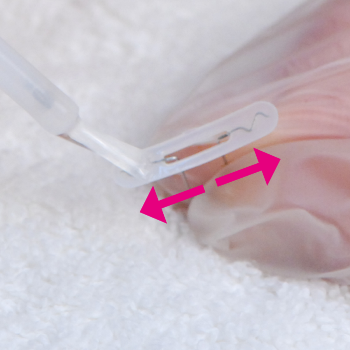 Languettes d’orthonyxie pour ongles incarnés et déformés - Différentes tailles - Podofix - My Médical