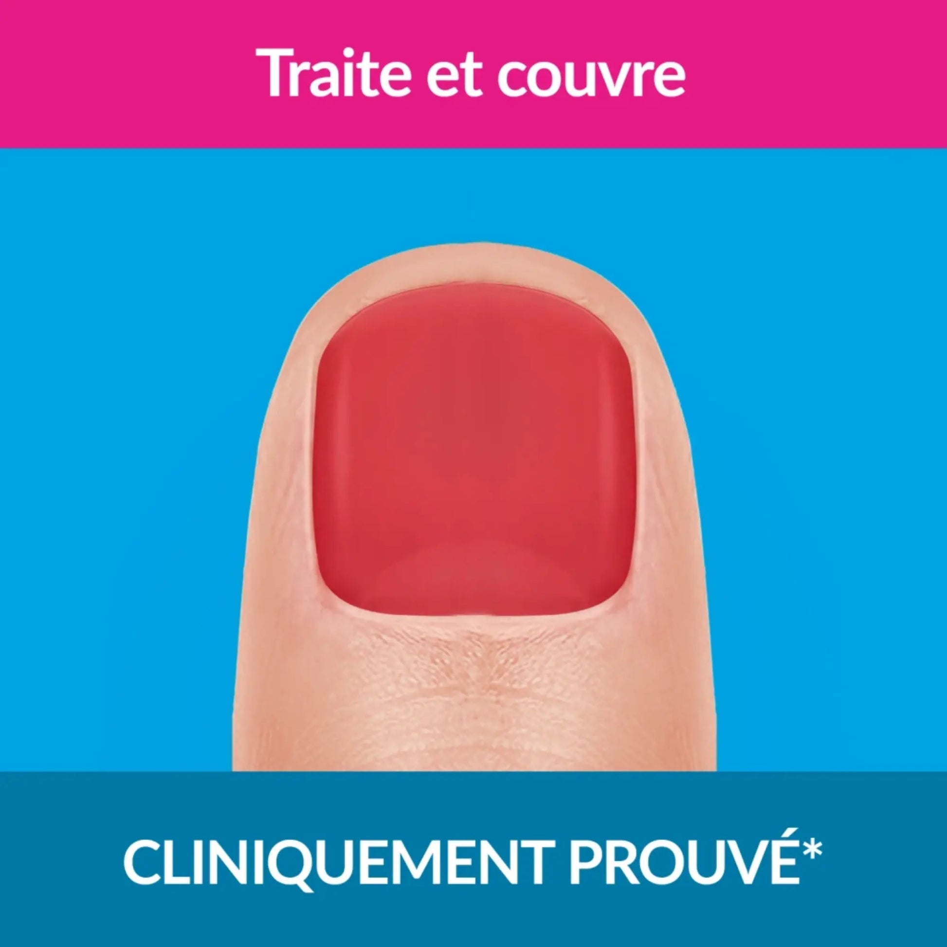 Traitement mycose ongles forte couleur red 30ml - Excilor Excilor 