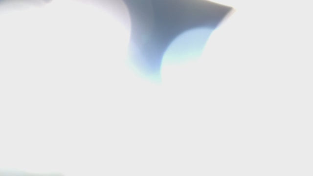 Cargar vídeo: Lampe d'examen Visiano 20 Derungs - 60 000 lux - Waldmann